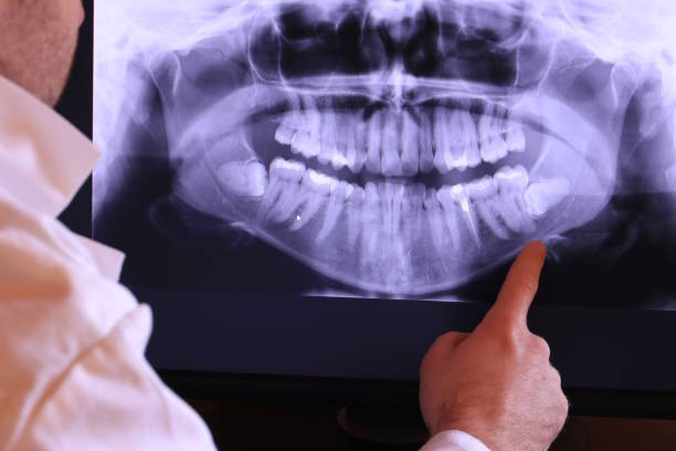 Best Emergency Broken Tooth Repair in Somerset, TX