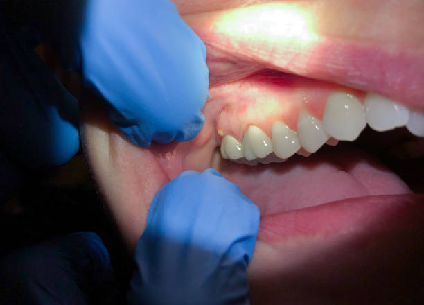 Best Emergency Treatment for Toothache in Somerset, TX