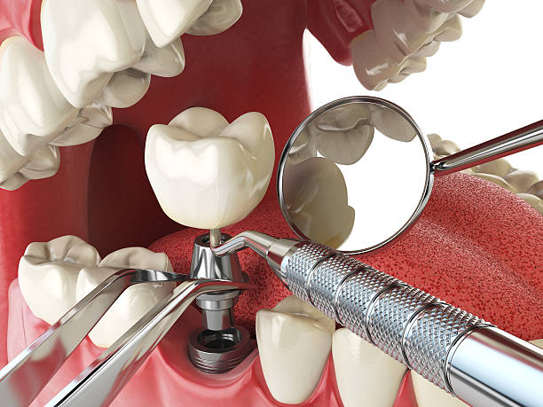 Best Emergency Dental Surgery in Somerset, TX